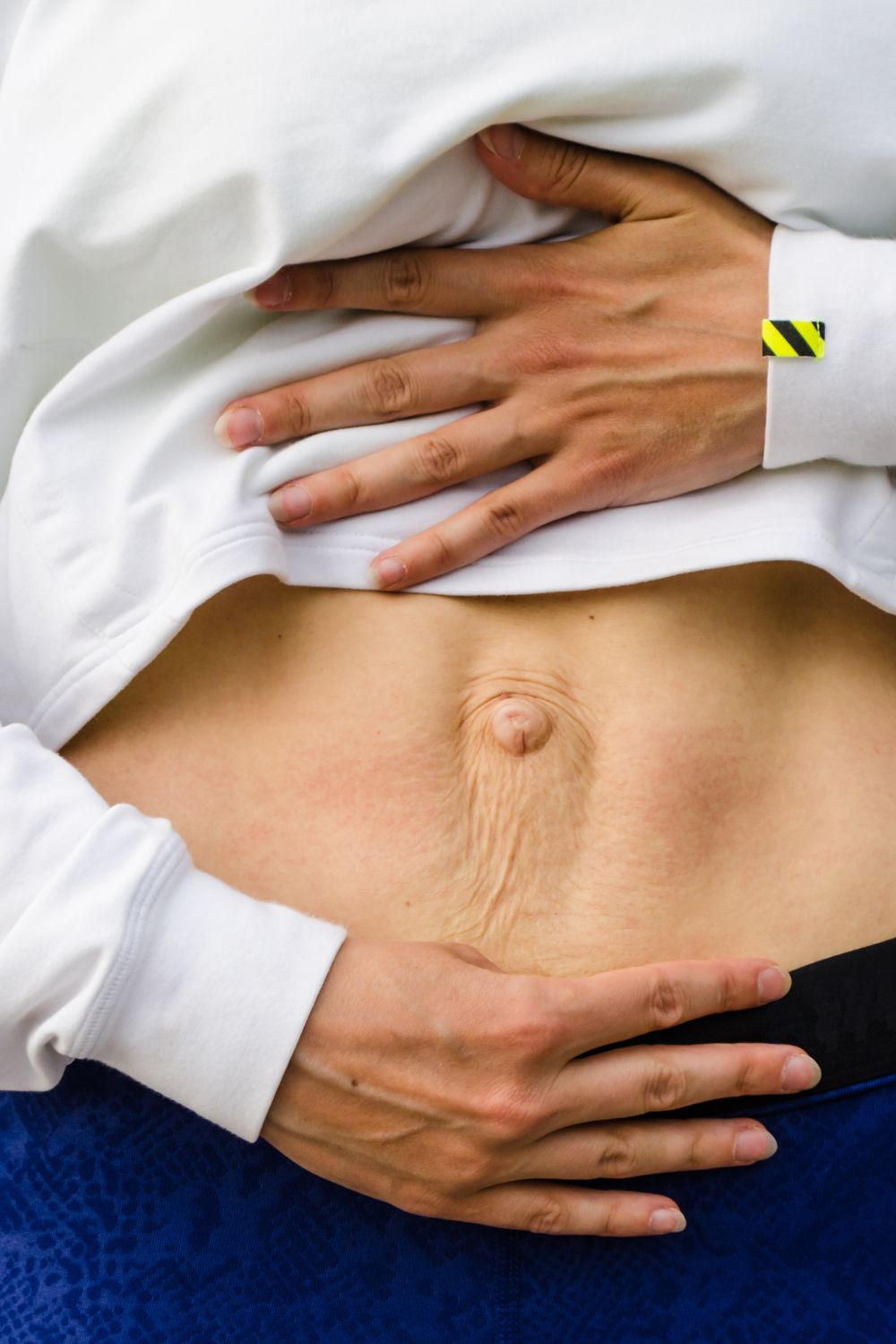 Postpartum stomach showing diastasis recti abdominals