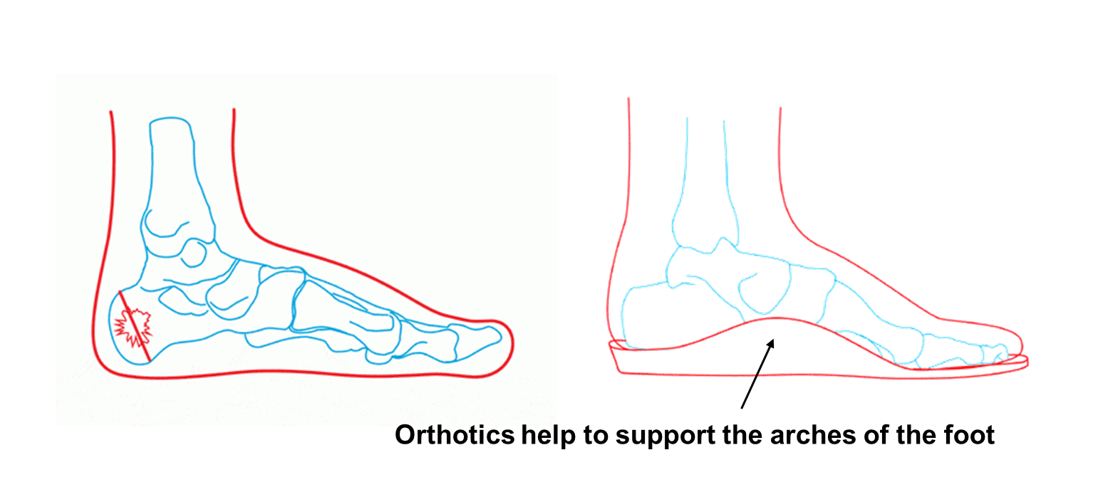 Work Boot Insoles How to Choose the Right Orthotics Ergonx