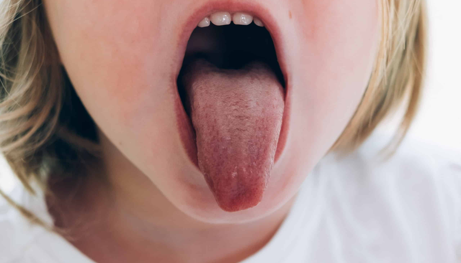 Nummen tunge: Når prikking og følelsesløshet ikke går over 11 Barn som rekker ut tungen i nærbilde med synlige melketenner øverst i munnen.