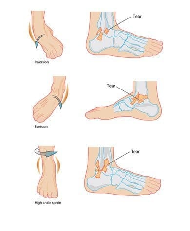 Ankle injuries are common in unpredictable environments.  Work boots with a high ankle support can help to minimize this risk.