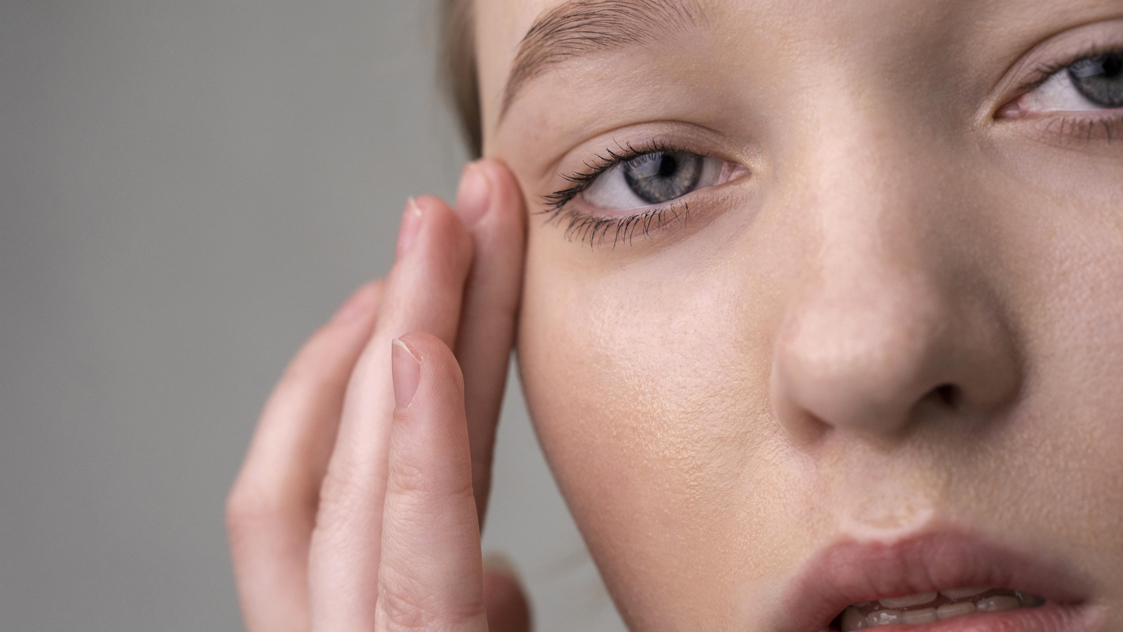 Plastyka powiek – blizny u kobiety na zdjęciu.