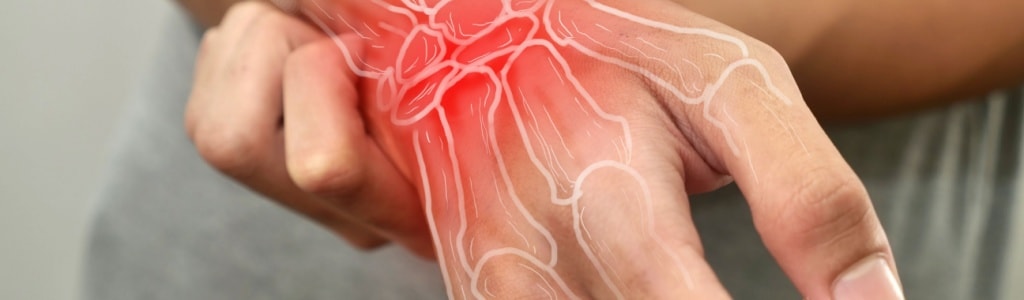 Employees may qualify for workers' compensation for hand injuries at work in California. 