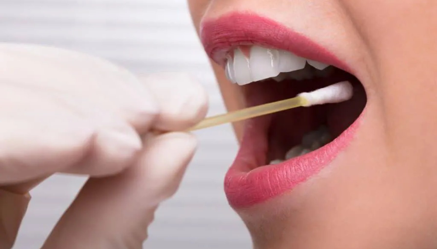 En bomullspinne tas fra innsiden av munnen på en kvinne for analyse, ofte brukt til bakterieprøver eller DNA-testing.