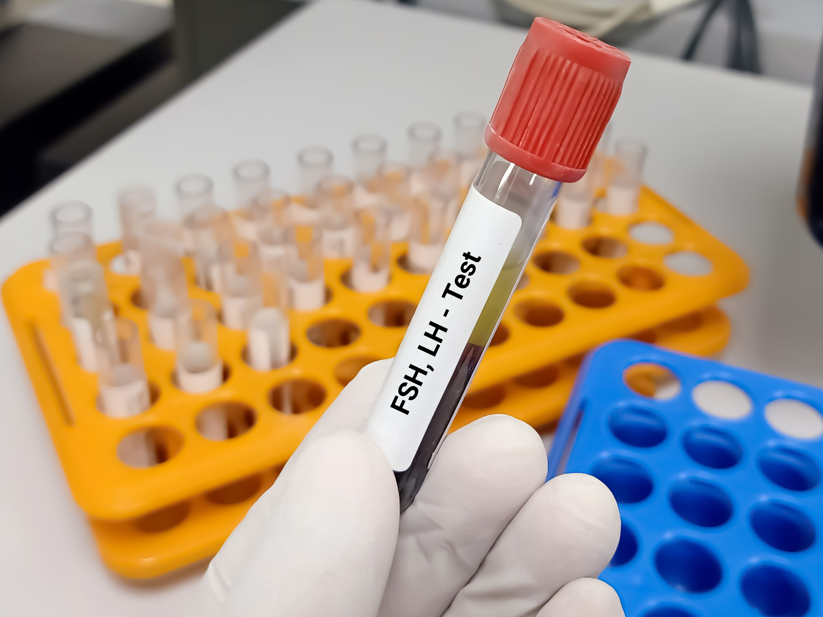 The FSH test is conducted on blood samples.
