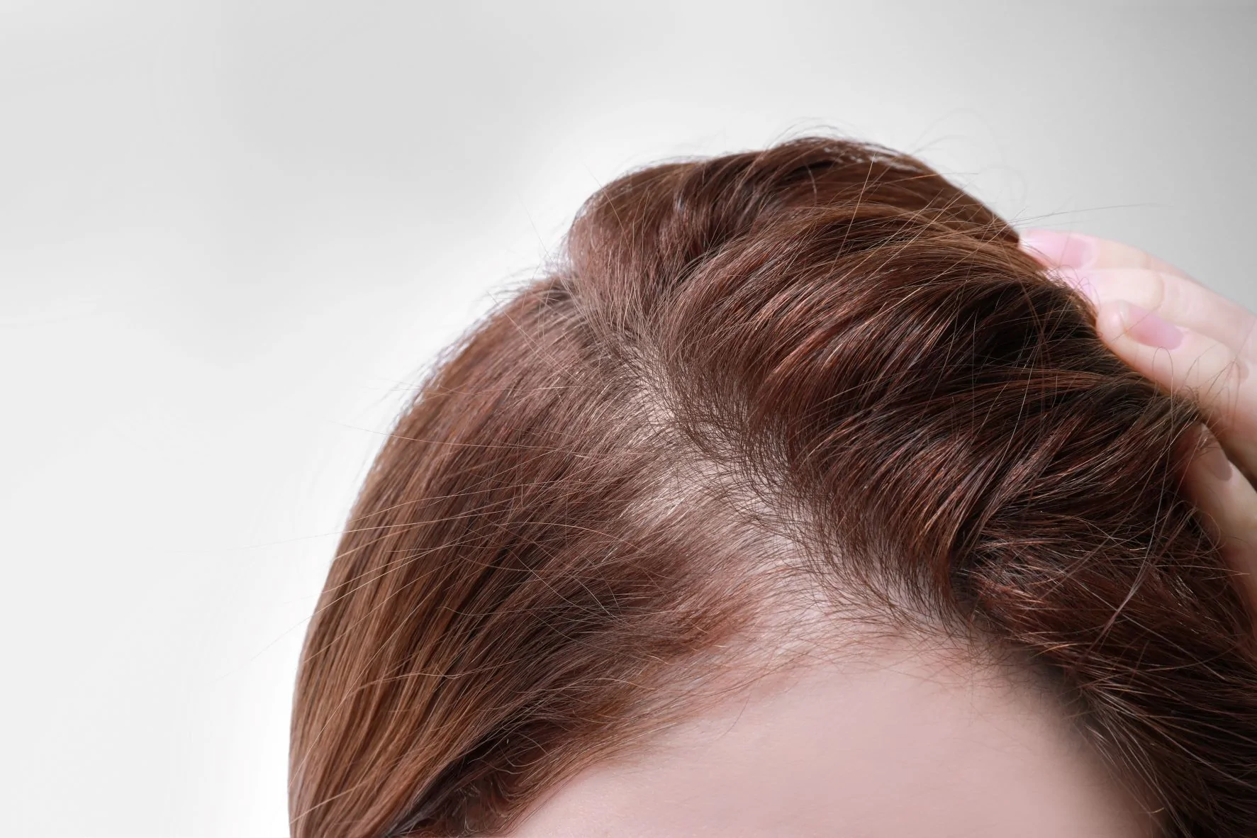 minoxidil stop hair thinning