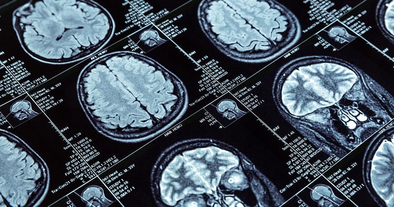 Before logic engages, the brain scans for safety, threat, and reward.