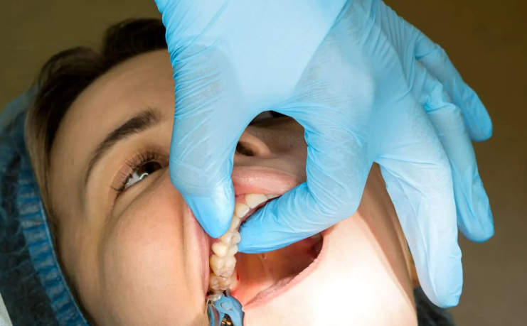 dental treatment