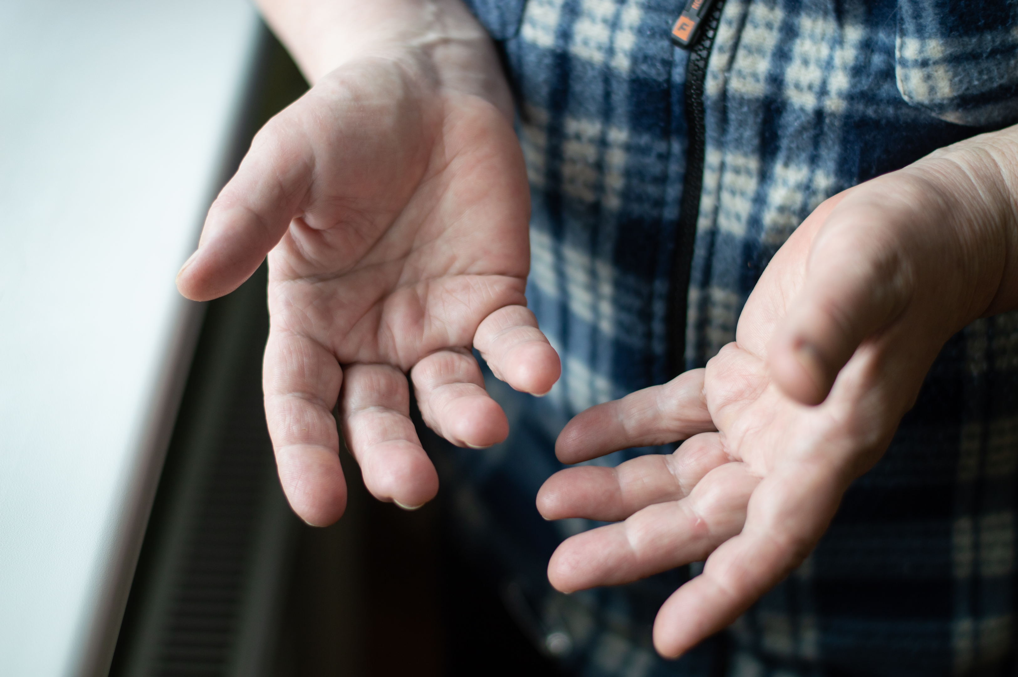 Image of an enderly person's hands.  Participants wore a vibrating glove for several hours in a group clinical trial to determine if vibration can be helpful for PD