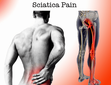 Sciatica Pain starts in the back and refers down your leg to the foot or ankle.