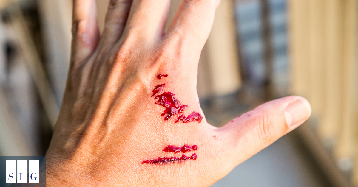 Why a Dog Bite Expert Witness Matters in Your Dog Bite Claim