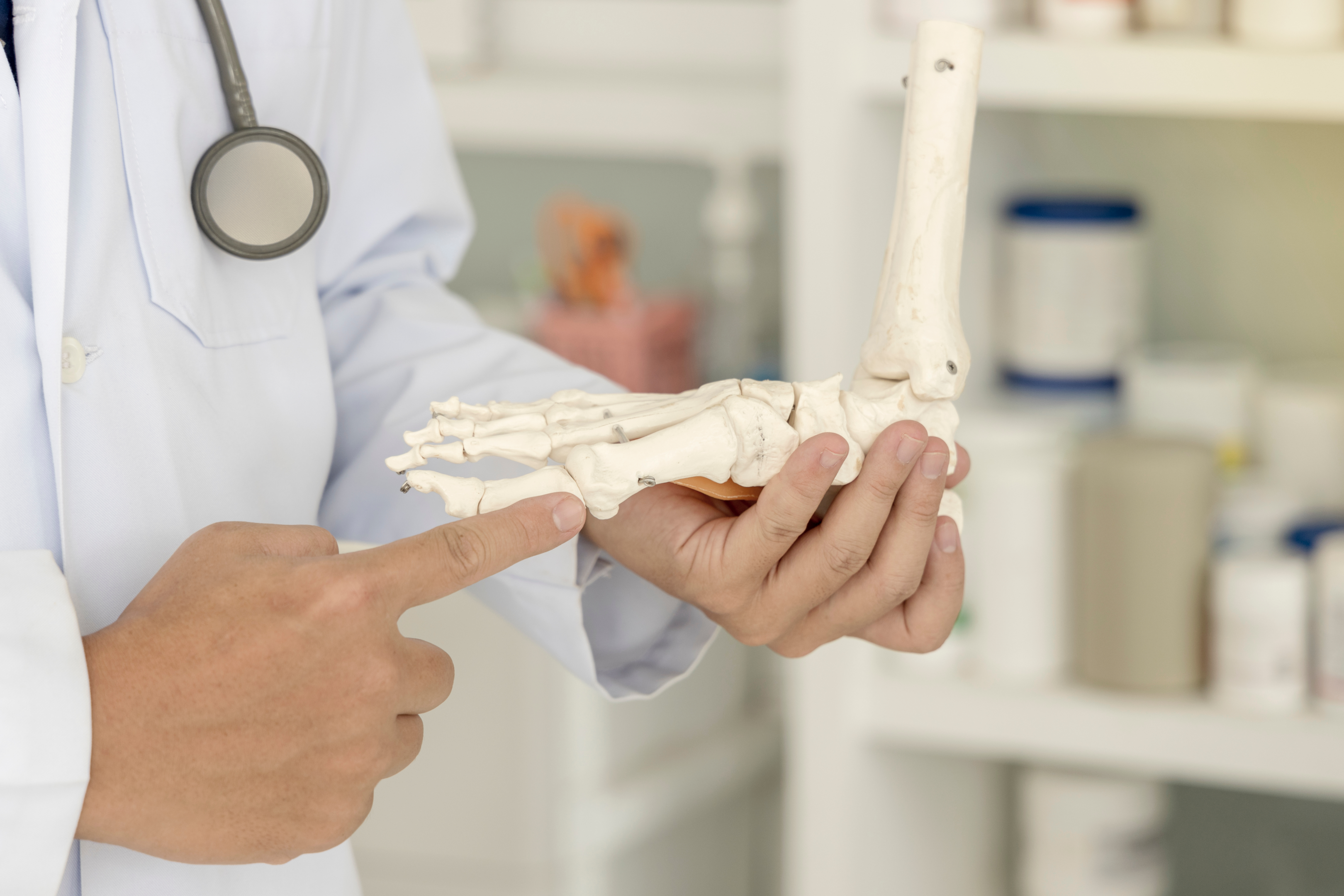 Läkare som pekar på ett skelett och förklarar en hallux valgus operation