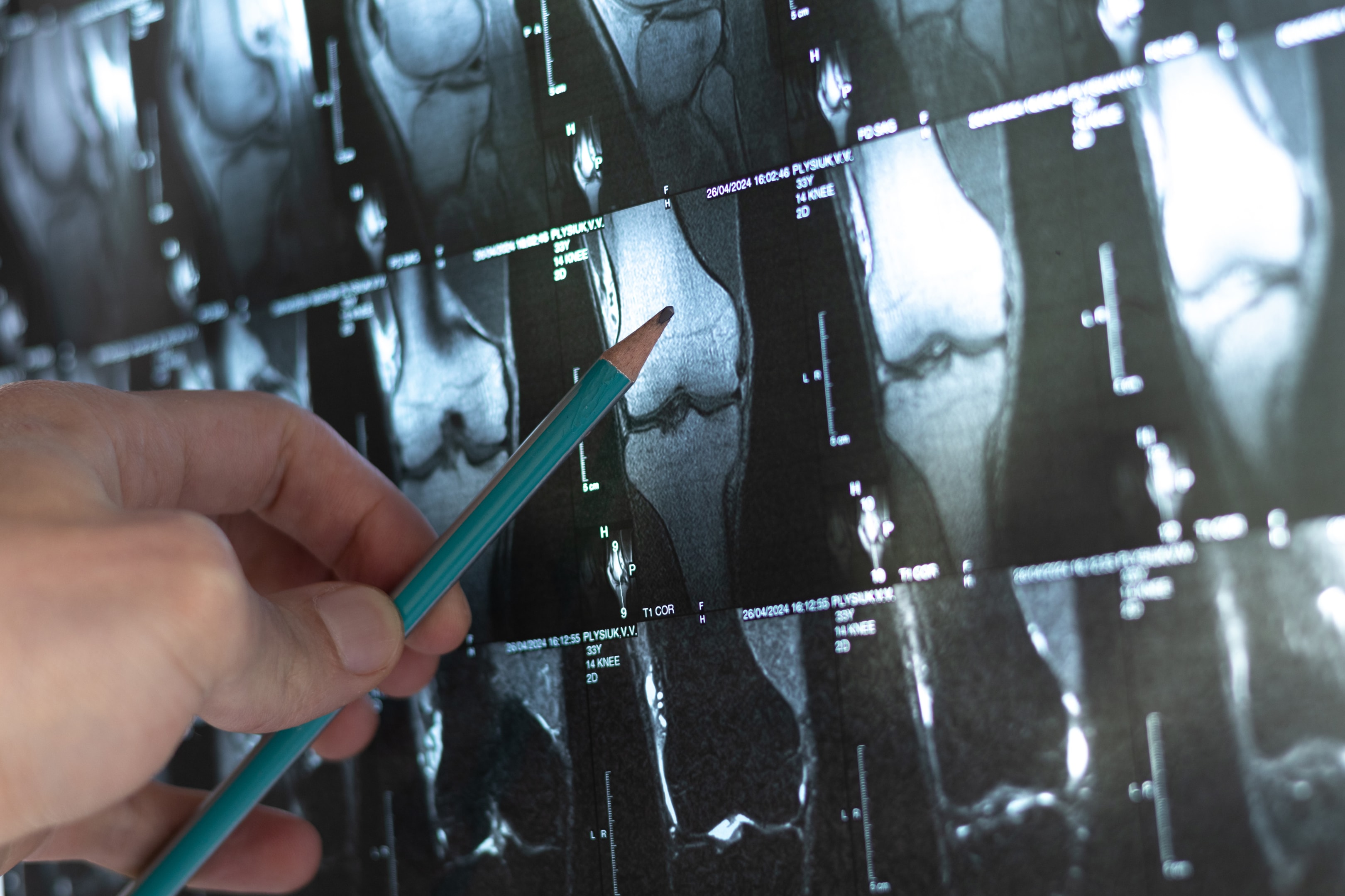 limb x ray | Sunshine Urgent Care