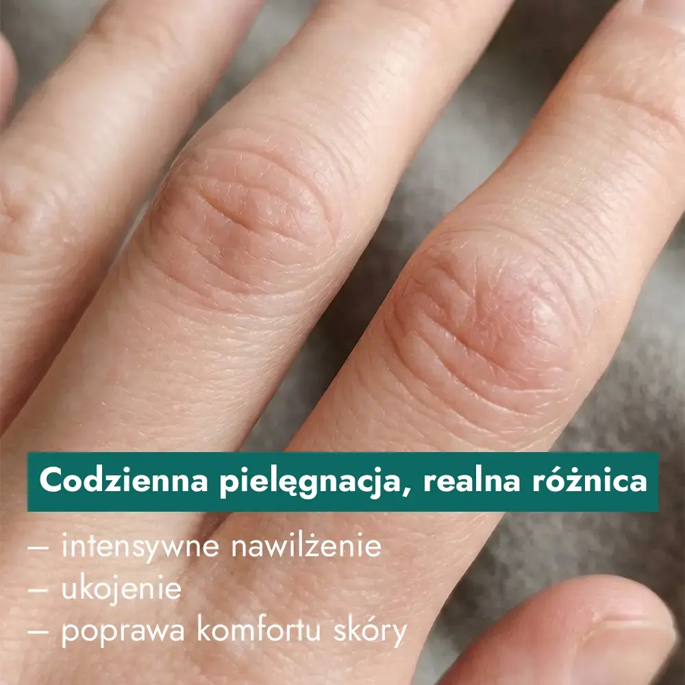 pielęgnacja skóry wrażliwej i atopowej