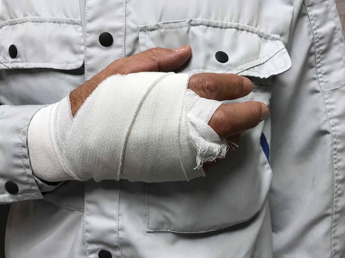 Workers' injury