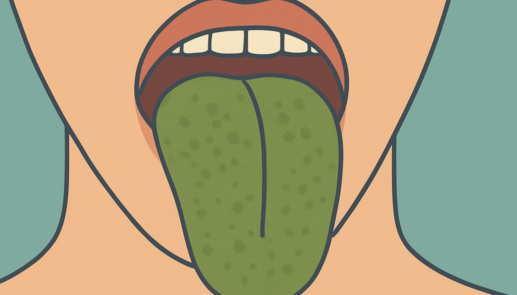 Grønn tunge – Hva det betyr og hvordan behandle det 16 Illustrasjon av åpen munn med grønn tunge, viser misfarging forbundet med infeksjon eller livsstilsfaktorer.