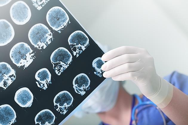 Doctor looking at CT scans of the brain