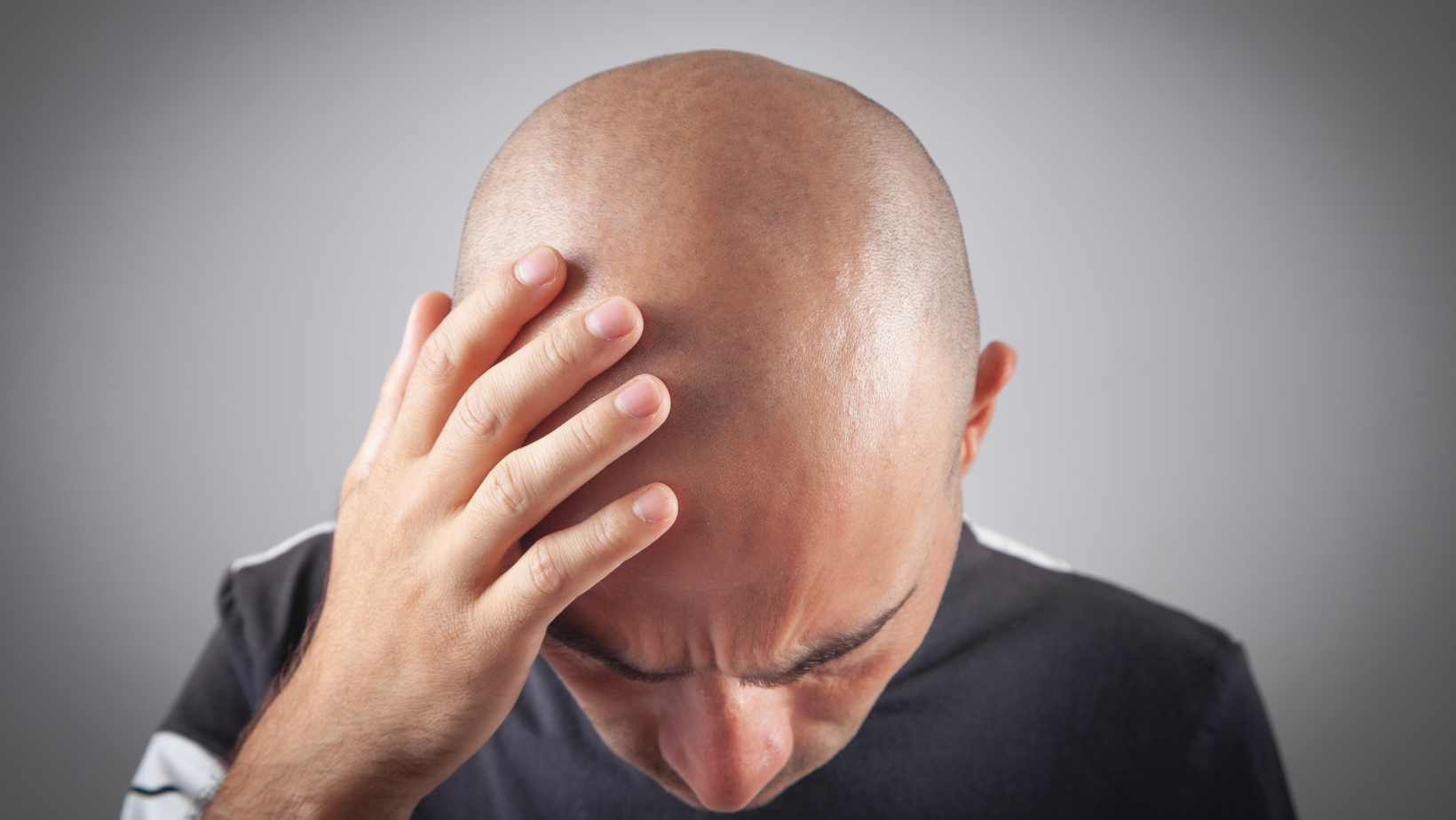 Activities to avoid during hair transplant recovery time