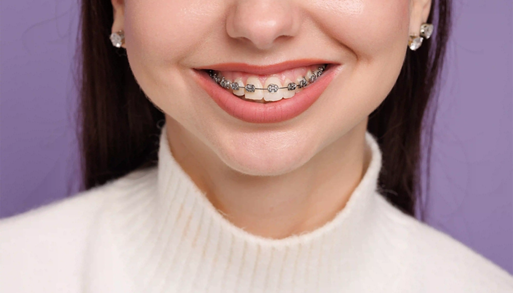 Smilende kvinne med tannregulering på fortennene, iført hvit genser og øredobber, står foran en lilla bakgrunn.