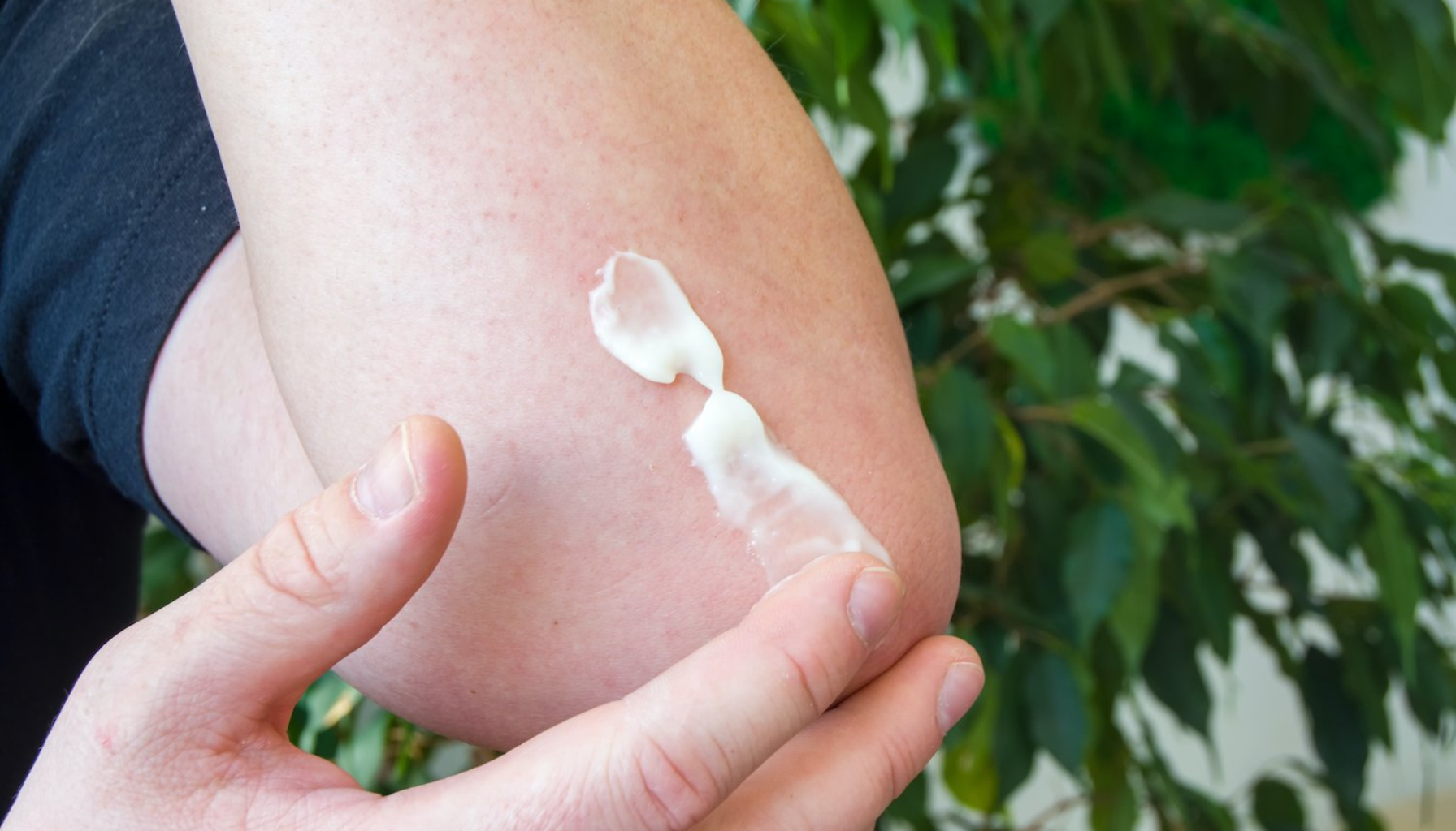 Hånd påfører krem på albuen, viser behandling av tørr eller irritert hud i naturlig miljø.