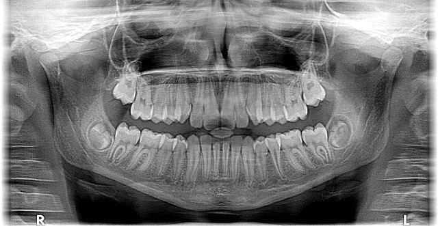 xray x-ray, x-ray, photo