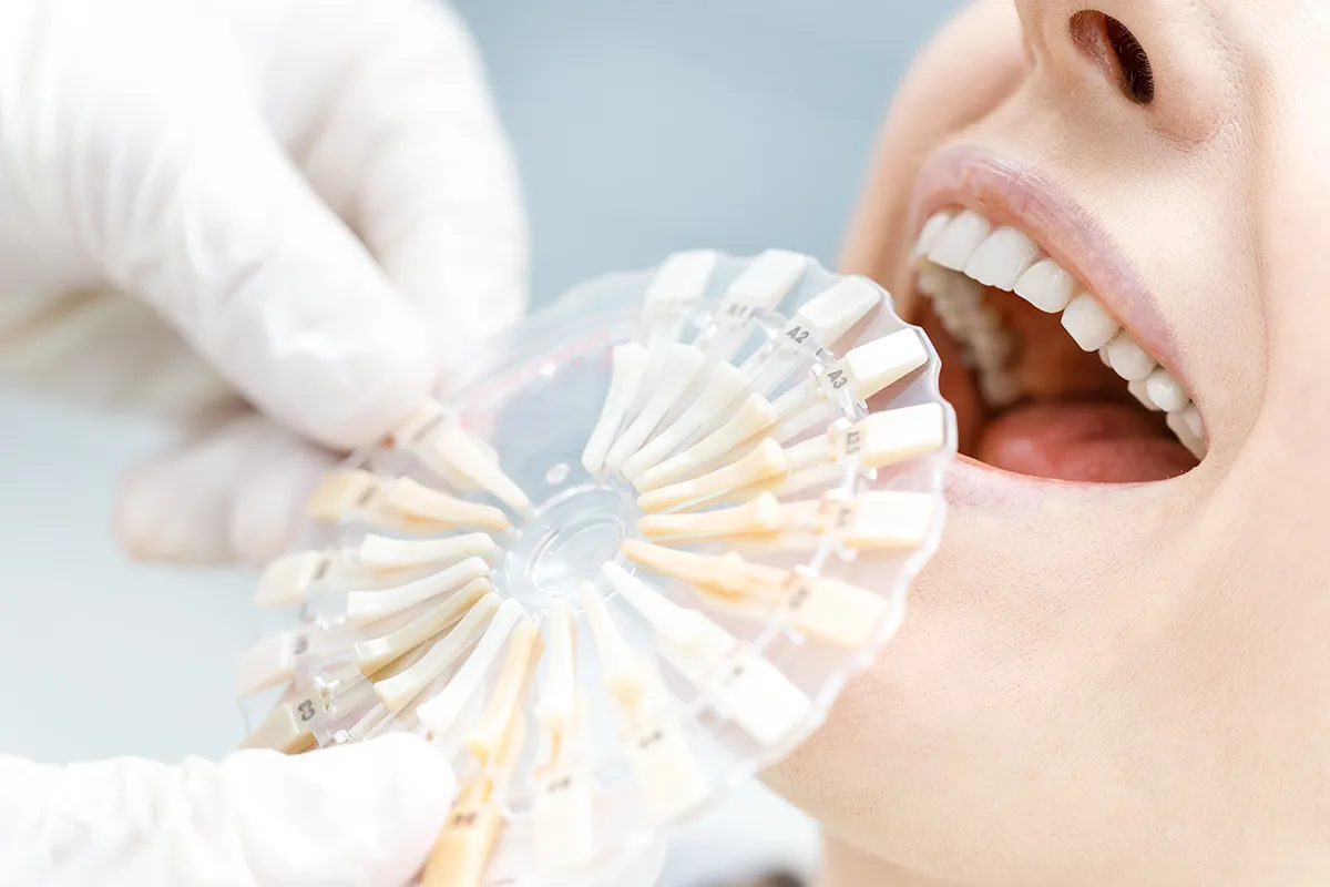 Close-up of a dental shade guide being held by a dentist next to a patient's teeth to compare and match tooth color.