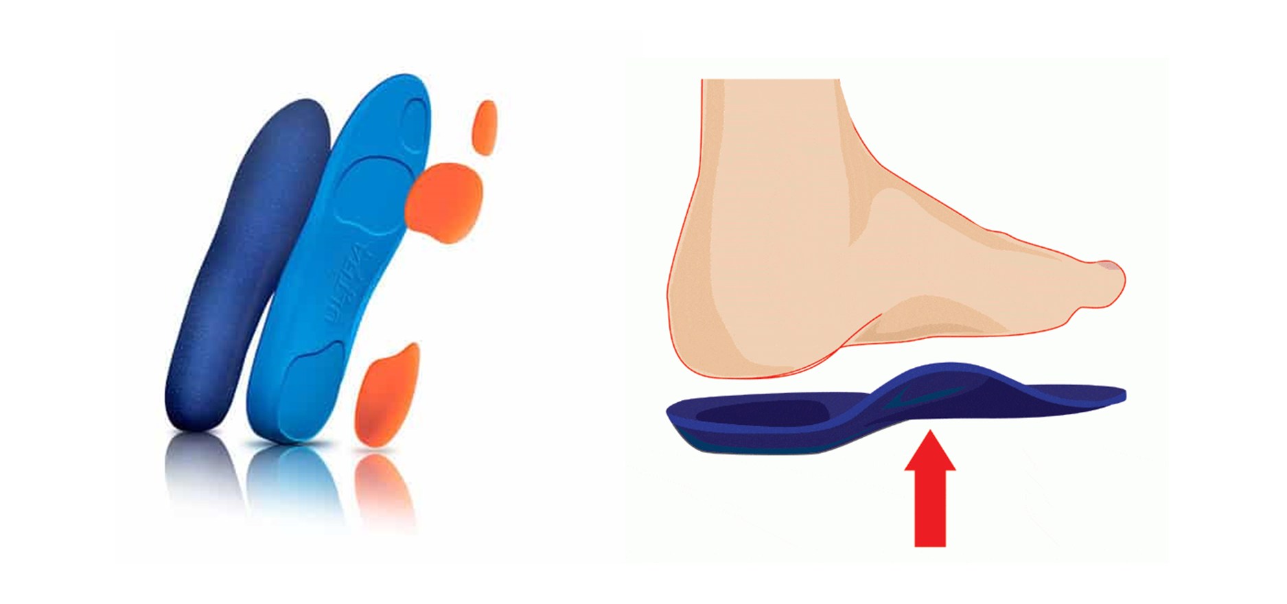 What are the Best Orthotic Insoles for Shoes Ergonx