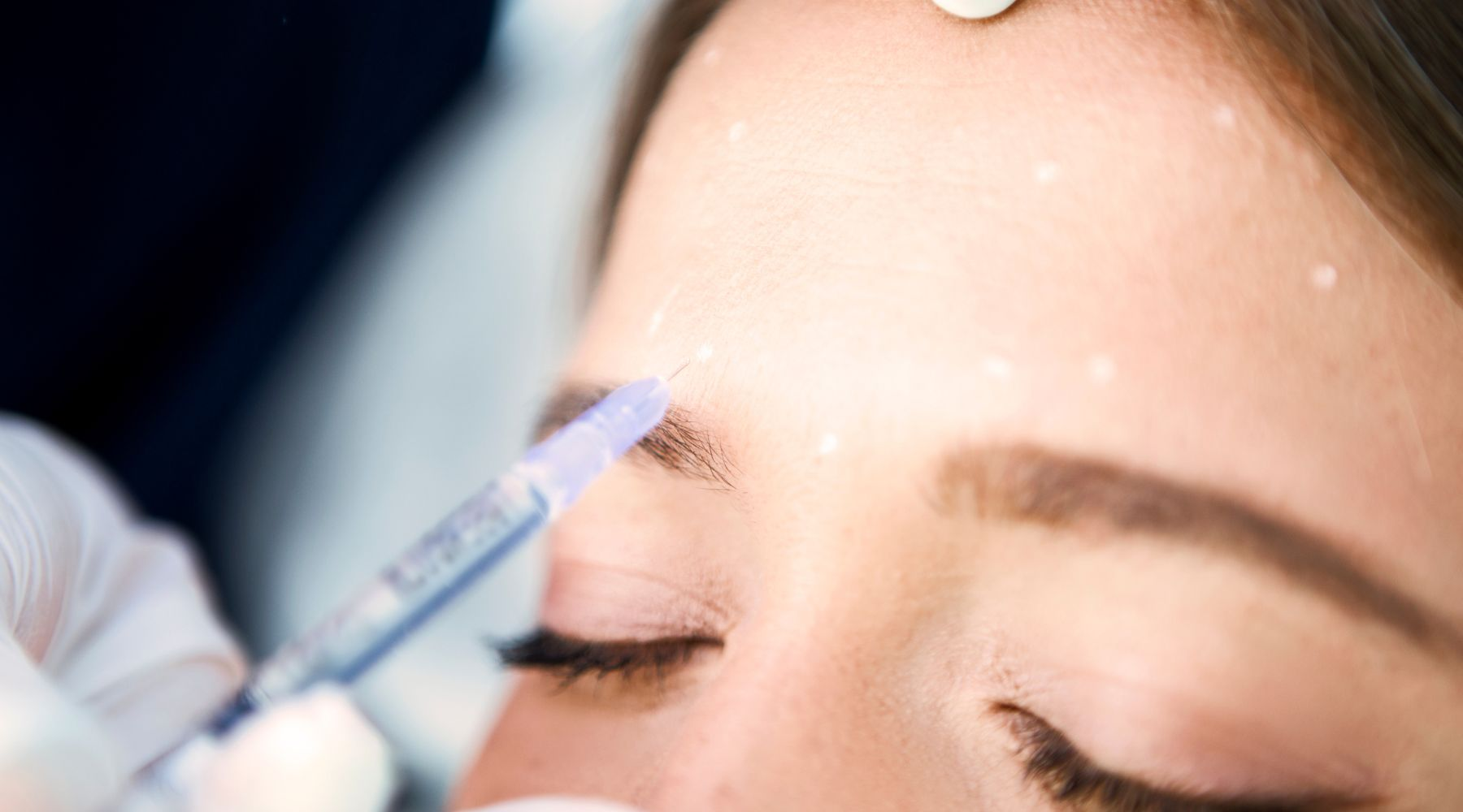 Administering a forehead injection with a fine needle.