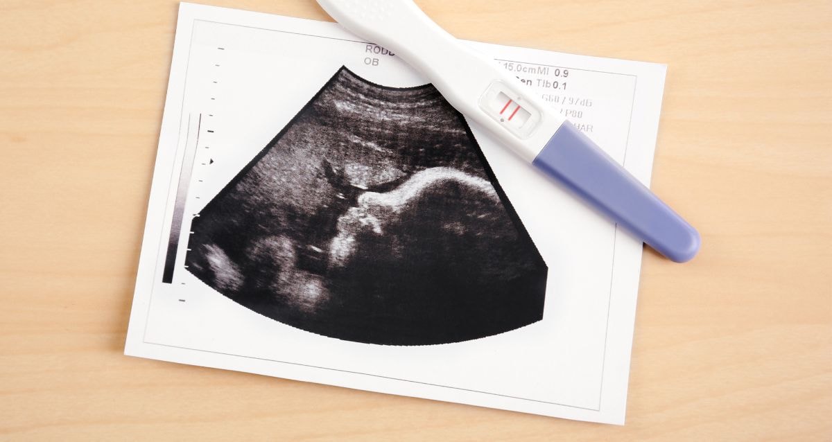 Positive pregnancy test and baby scan of a healthy surrogacy pregnancy 
