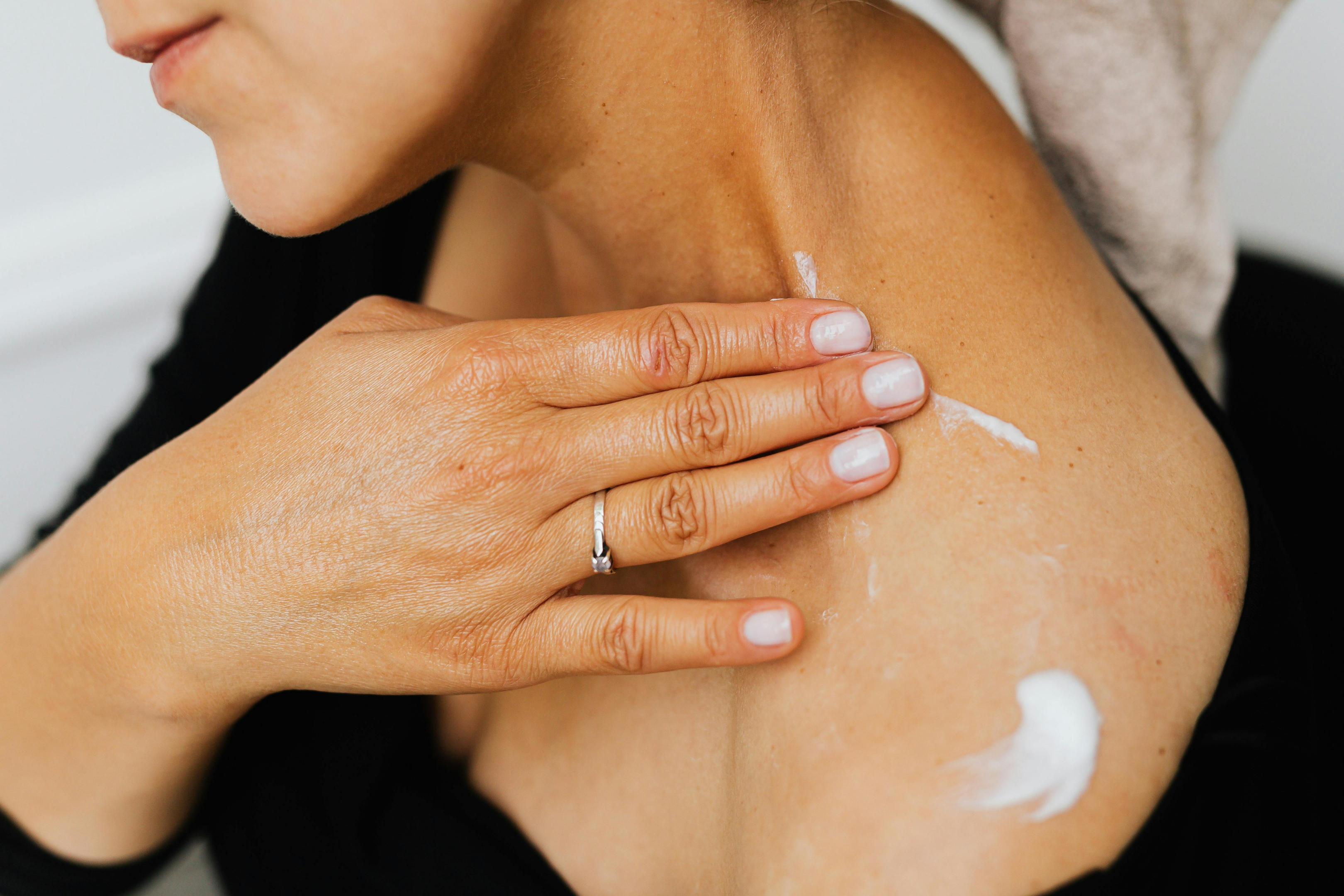 A close-up of a woman applying white ointment between her neck and shoulder.