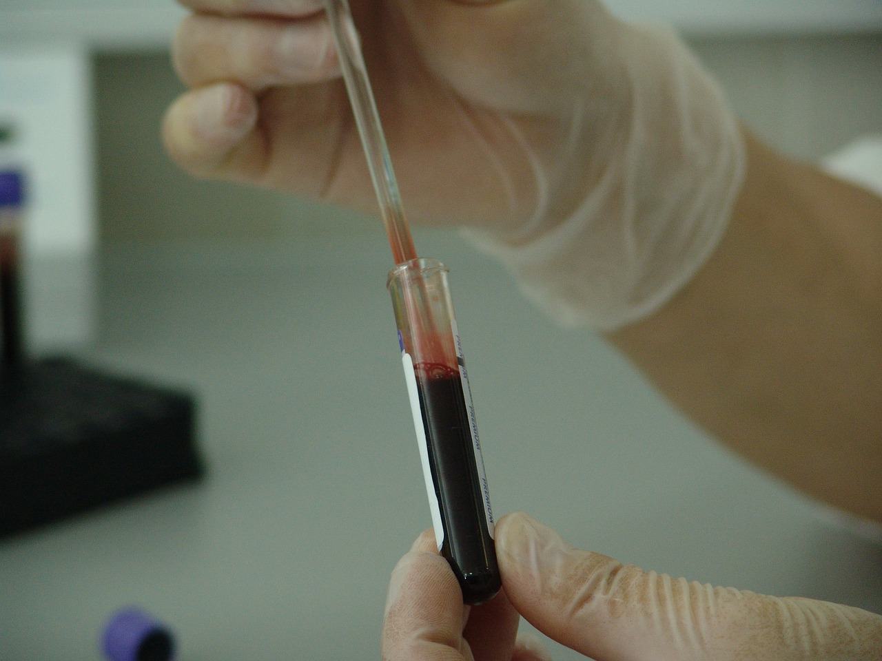 An image of a doctor analyzing a patient blood test for allergies. 
