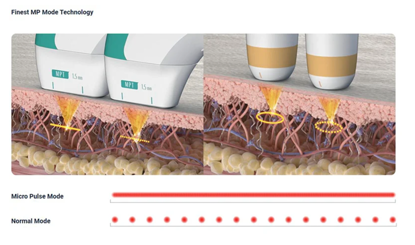 Micro Pulsed Technology