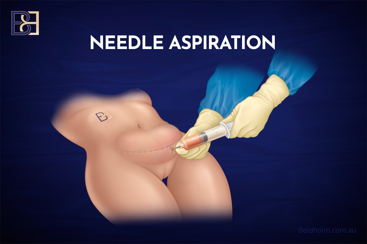 a6095268 23ac 4e24 9863 9989d1050fed