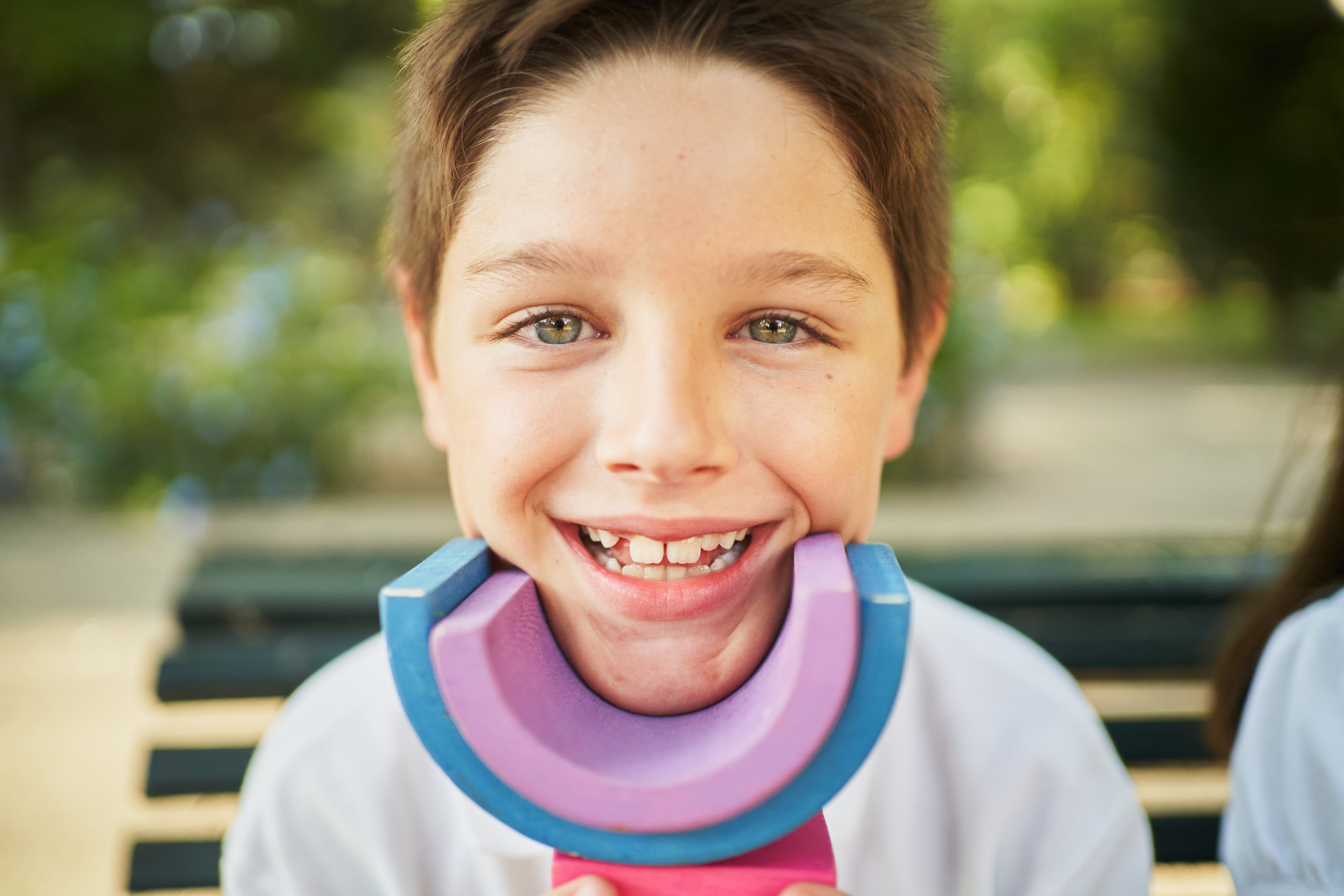 A photo of a boy finally smiled after tooth inflammation.