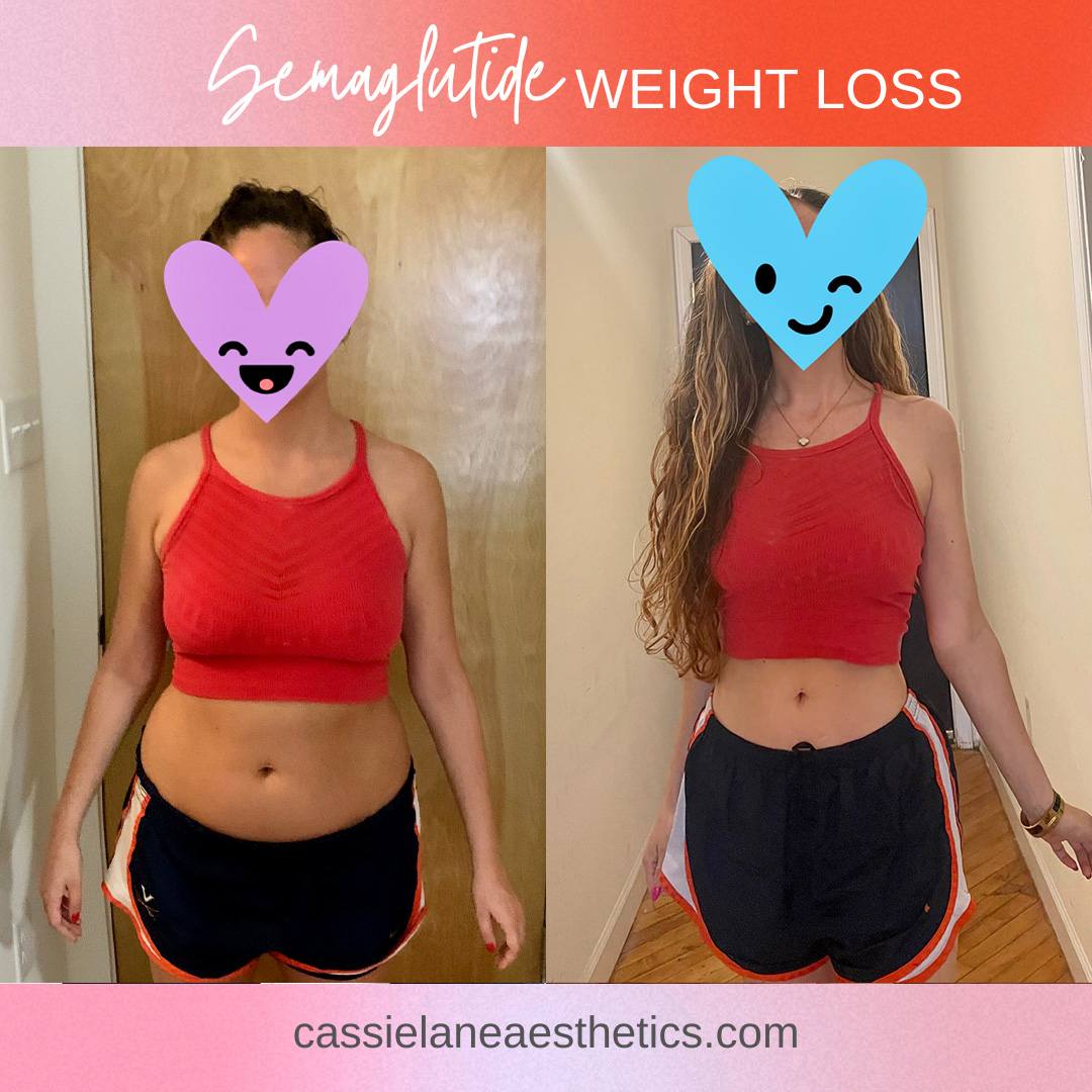 semaglutide weight loss results