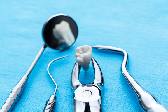 dental tools used in the surgical extraction of wisdom teeth 