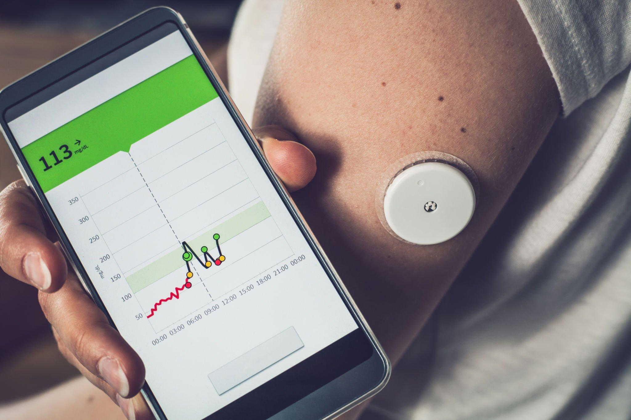 A person displaying CGM data, revealing blood glucose levels, a vital aspect in managing and monitoring type 2 diabetes.