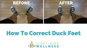 How To Correct Duck Feet (Feet Turn Out) | Step By Step Program - YouTube