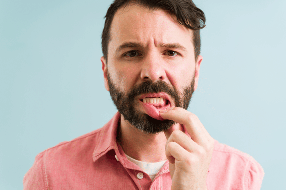 male holding his lip down showing his gum disease