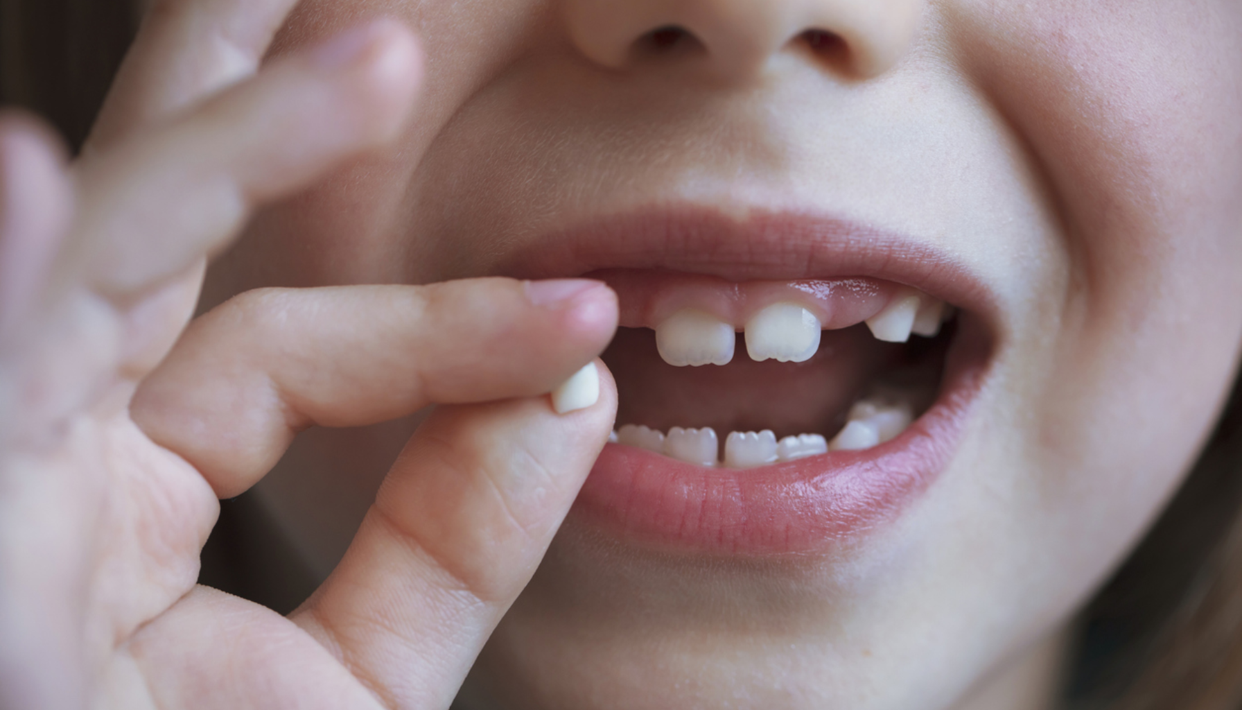 "Barn mister en melketann og holder den i hånden mens hullet i tannrekken vises."