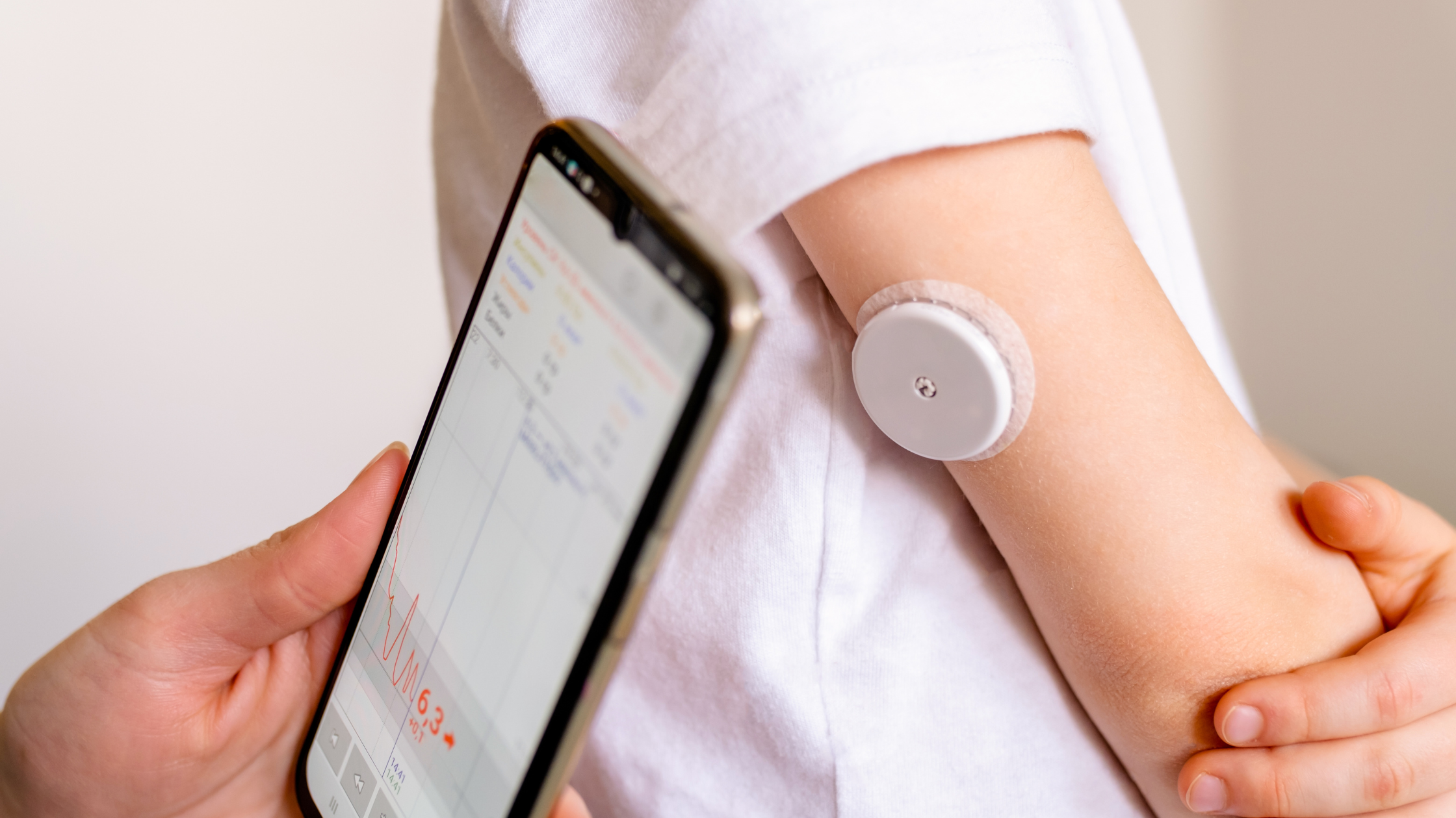 updating glucose levels data from CGM with smartphone app