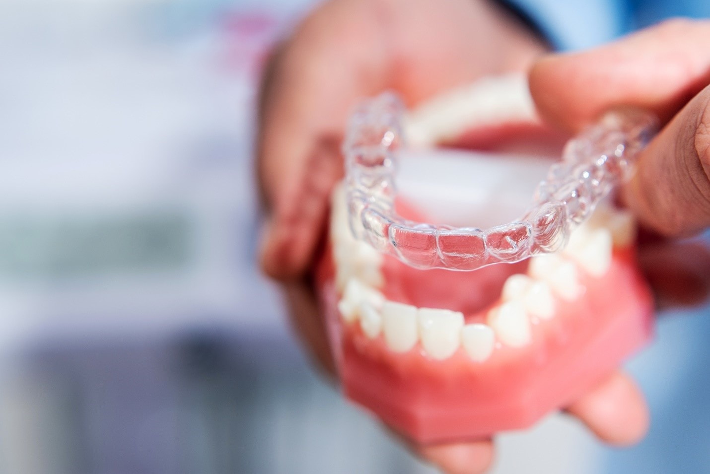 How Long Does Invisalign Take