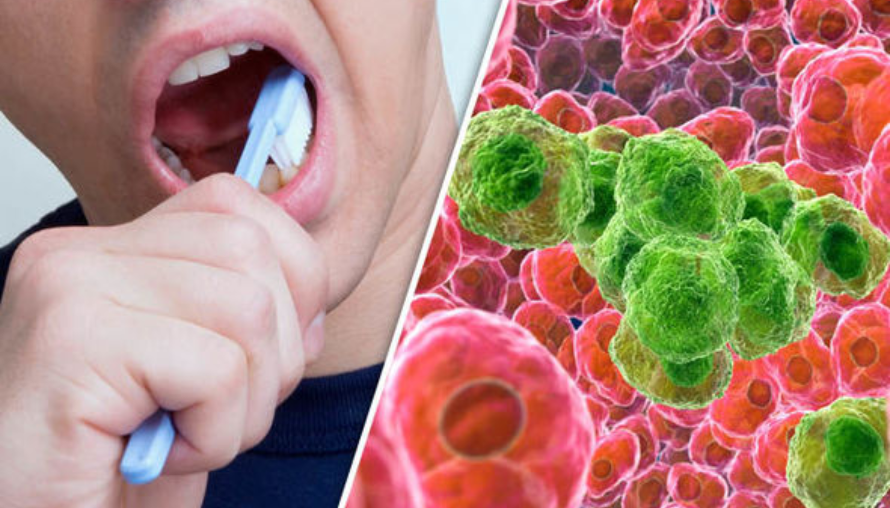 Mann pusser tennene, kombinert med nærbilde av kreftceller i mikroskopisk visning.