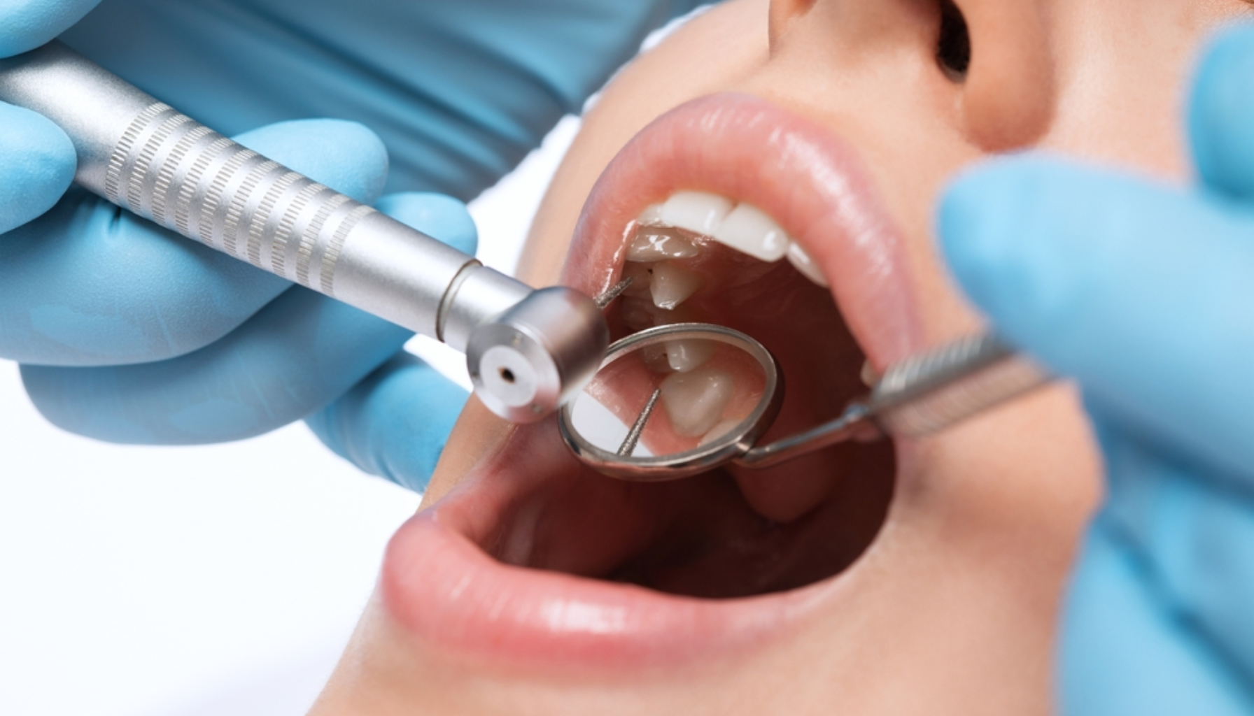 Trekke Tann: Når Det Ikke Lenger Er Noe Å Redde (Men Alt Å Vinne) 15 Tannlege bruker boremaskin og speil for å undersøke tenner på pasient med blå hansker og åpen munn.