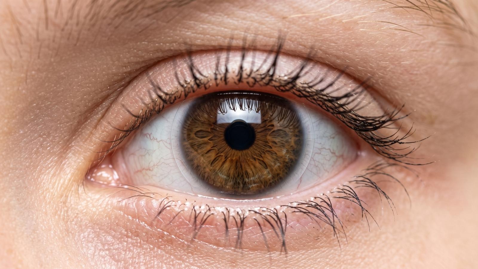 contact lens wearer