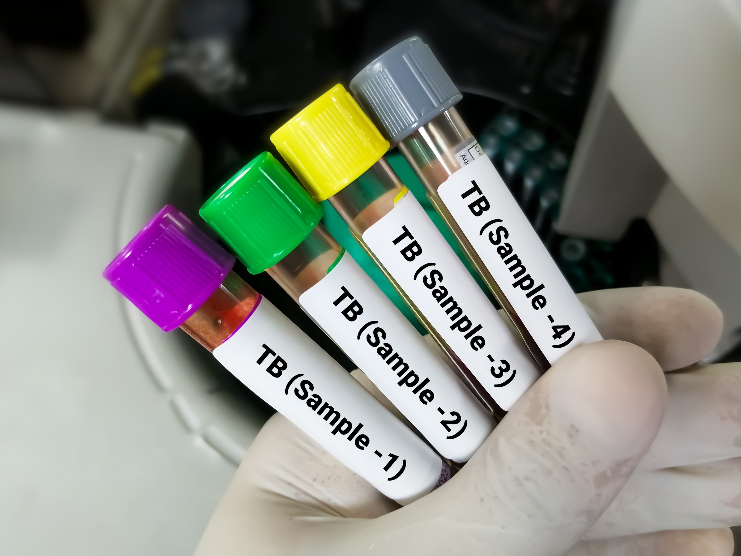 infectious disease test tubes
