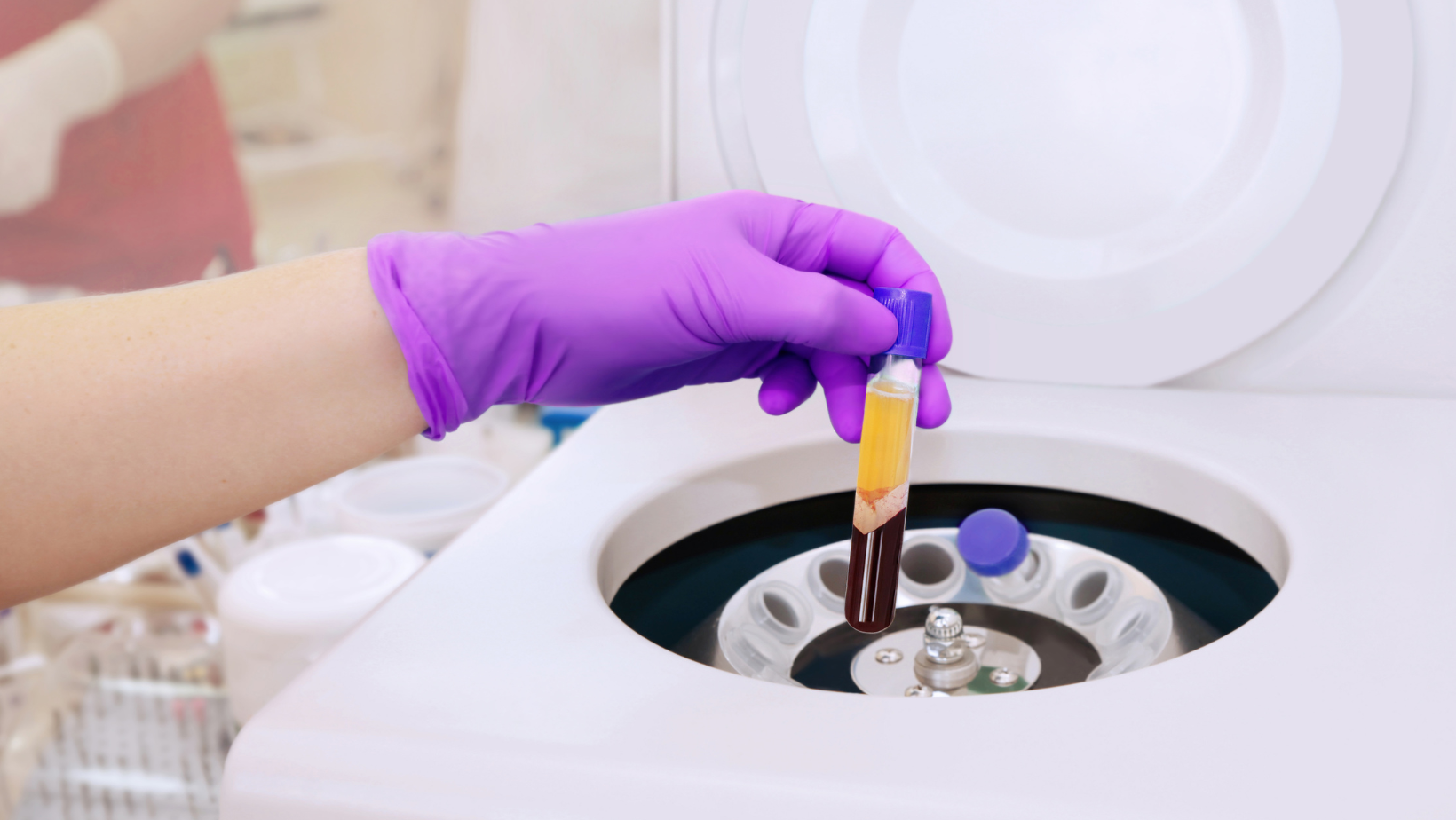 What is prp therapy?