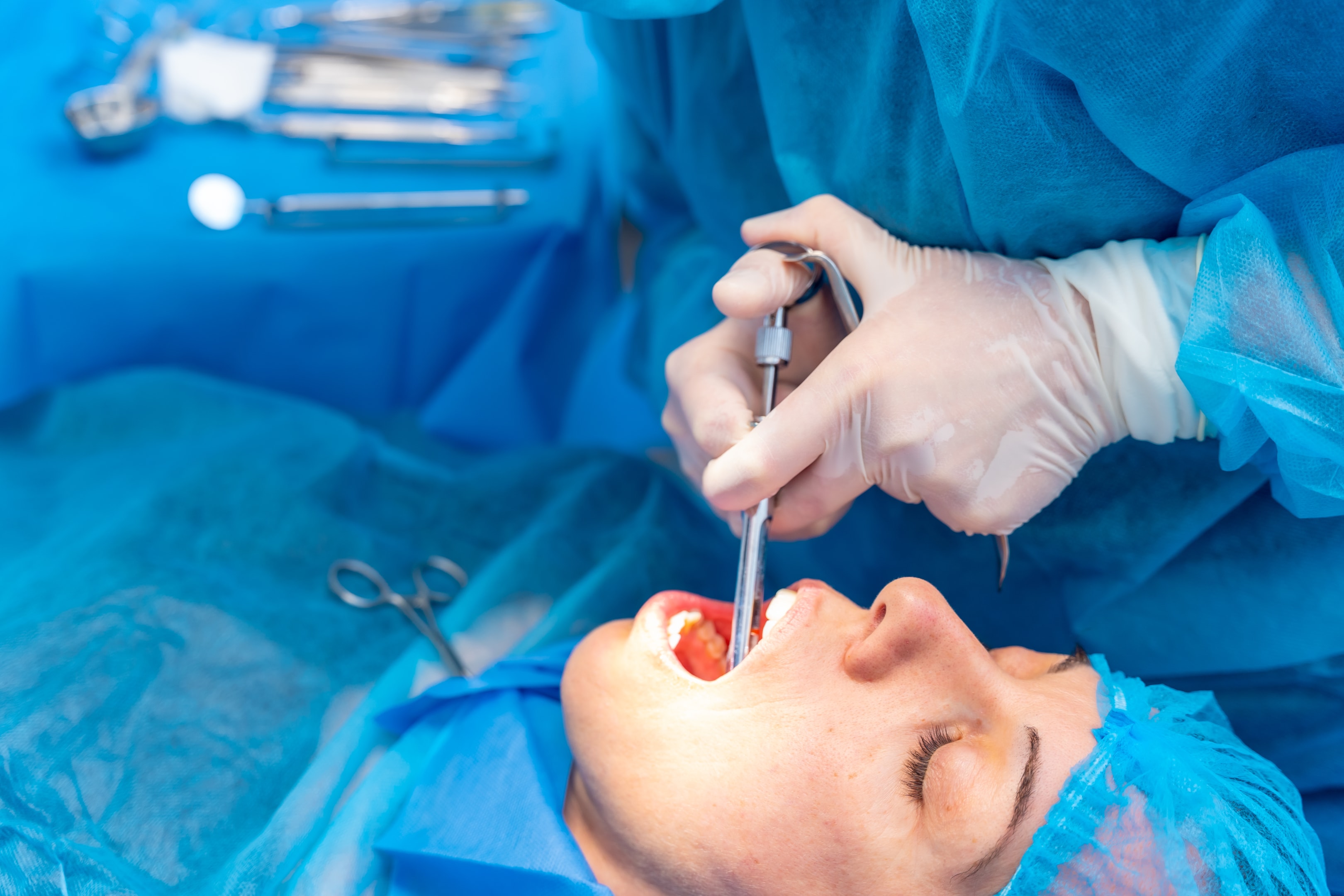 A photo of a woman in the operating room undergoing calgary  teeth extraction