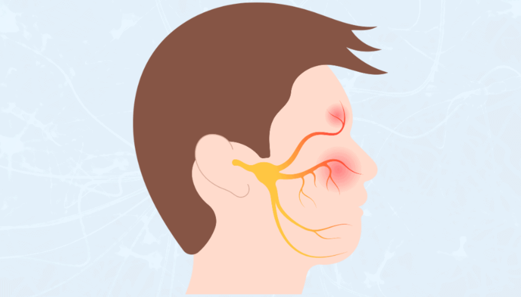 Trigeminusnevralgi: Den intense ansiktssmerten Trigeminusnevralgi: Den intense ansiktssmerten