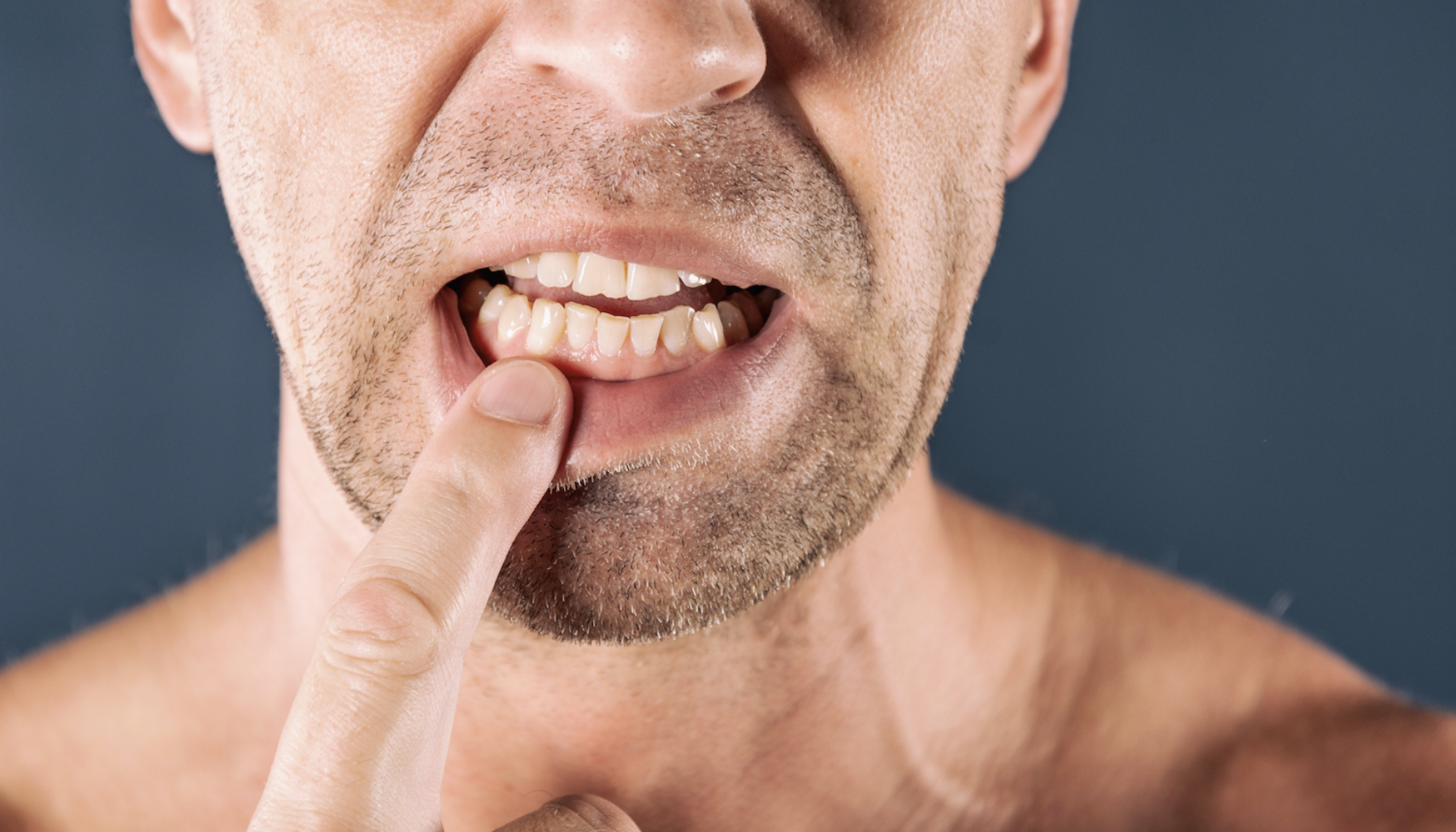 Gom Tenner: Når Tennene Ikke Møtes Som De Skal 13 Mann peker på tannkjøtt med bekymret uttrykk, viser mulig betennelse, irritasjon eller smerte relatert til munnhelse hos