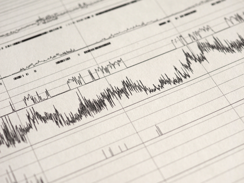 polysomnography sleep study wave chart